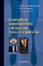 Amputacion De Extremidad Inferior Y Discapacidad: Protesis Y Reha Bilitacion