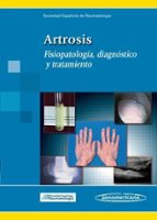 Artrosis: Fisiopatologia, Diagnostico Y Tratamiento
