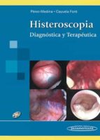 Histeroscopia: Diagnostica Y Terapeutica
