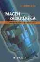 Imagen Radiologica: Principios Fisicos E Instrumentacion