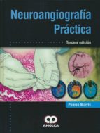 Neuroangiografia Practica