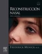Reconstruccion Nasal + Dvd-rom