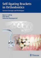 Self-ligating Brackets In Orthodontics: Current Concepts And Tech Niques