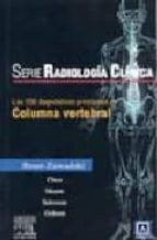 Serie Pocket De Radiologia: Los 100 Diagnosticos Principales En C Olumna Vertebral