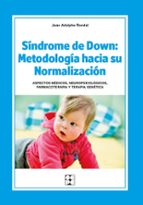 Sindrome De Down: Metodologia Hacia Su Normalizacion