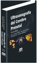 Ultrasonografia Del Cerebro Prenatal